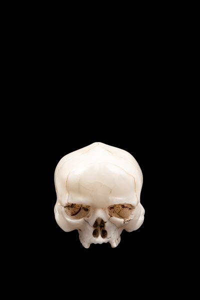 Memento mori in alabastro, teschio con volto sofferente in urlo, Germania XVII secolo
